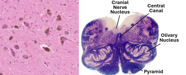 Fig. V7. The H&E-stained section of the substantia nigra (left) shows dopaminergic multipolar nerve cell bodies containing dark neuromelanin granules. The section on the right is of the medulla oblongata showing its general appearance.