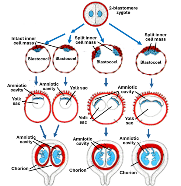 Fig. 5.10. The illustration summarizes the processes of the different types of monozygotic twins. On the left sides monozygotic twins with separate fetal membranes, in the middle with separate amniotic sacs and shared chorion and on the right with shared amniotic and chorionic sacs.