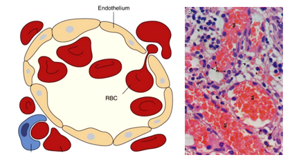 Fig. N30. An illustration and an H&E-stained histological section showing the structural features of sinusoids, as blood vessels with wide lumina lines only by endothelium. The endothelium could discontinuous or fenestrated.