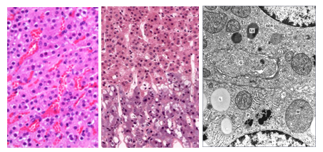 Fig. S18. The H&E-stained histological of the zona fasciculata shows the endocrine cells arranged in anastomosing cords separated cords separated by sinusoids (blood filled). The histological section (middle) shows the border between the zona reticularis (above) and the adrenal medulla (below). The electron micrograph on the left shows adrenal cortical cells to be rich in sER, with a well-developed Golgi (G) and lipid droplets (L).