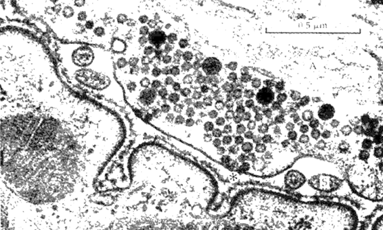 Fig. F11. A transmission electron micrograph of a motor endplate showing numerous clear vesicles (cholinergic) in the efferent neve ending, and folds of the sarcolemma forming secondary synaptic cleft.