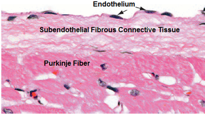 Fig N3. An H&E-stained section of the endocardium showing it component tissues, the endocardium and the subendothelial connective tissue. A bundle of Purkinje fibers is seen.