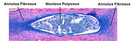 Fig. K20. A histological section of section of an intervertebral disc showing its two components the nucleus pulposus and the annular fibrosus.