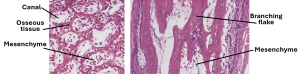 Fig. K13. Two H&E-stained histological sections showing the development of compact bone and spongy bone. Compact bone formation (left) is foreshadowed by the matrix laid down in circles (future Haversian systems), whereas in spongy bone formation (right), the bone matrix is laid down in branching flakes (future trabeculae). Both develop from mesenchyme.