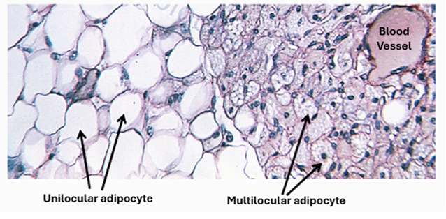 Fig. H19. A histological section showing white adipose tissue (left) and white adipose tissue (right). The white adipose tissue is made of unilocular adipocytes whereas the brown adipose tissue is made of multilocular adipocytes.