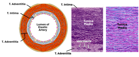 Fig N17. The illustration on the left shows the three tunics of elastic arteries. The tunica media is the most prominent. The histological section in the middle and in the right are stained by elastic stains which clearly show the wavy elastic laminae. The section in the middle shows blood vessels (vasa vasora) in the adventitia.