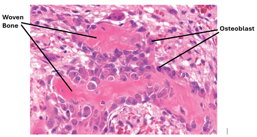 Fig. K9. An H&E-stained section of woven bone. The bone matrix is acidophilic (red) and is devoid of lamellae. This is a newly formed bone that has been deposited by the osteoblasts arranged in a single row on the bone surface.
