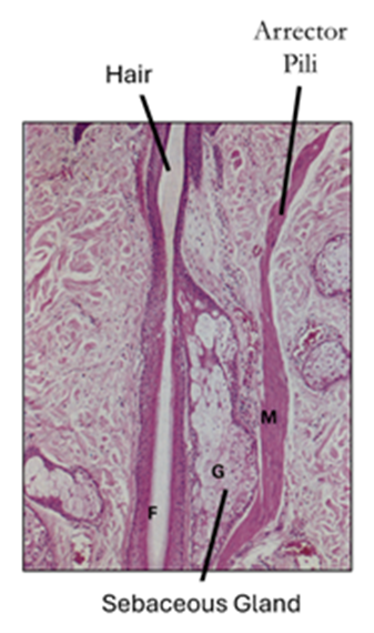 Fig. O23. An H&E-stained section of the pilosebaceous unit made of hair follicle, sebaceous gland and the arrector pili muscle.