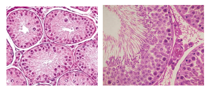 Fig. T6. Appearance of the somniferous tubules before (left) and after puberty (right). Tails of newly formed sperms are abundant within the tubular lumen of the mature testis.