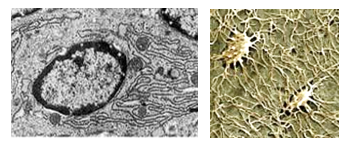 Fig. K5. A transmission electron micrograph of an osteoblast (left) showing an ovoid nucleus rich in euchromatin and a cytoplasm rich in rER, reflecting high activity of the cell in protein synthesis (collagen and ground substance). The scanning osteocyte (right) shows two osteocytes in lacunae. The cells have numerous complicatedly interconnecting fine processes.