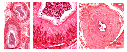 Fig. T12. H&E-stained sections show the general features of epididymis (left), its high pseudostratified epithelium with long hair-like stereocilia (middle), the general appearance of the vas deferens and its thick muscular wall surrounding a narrow lumen.