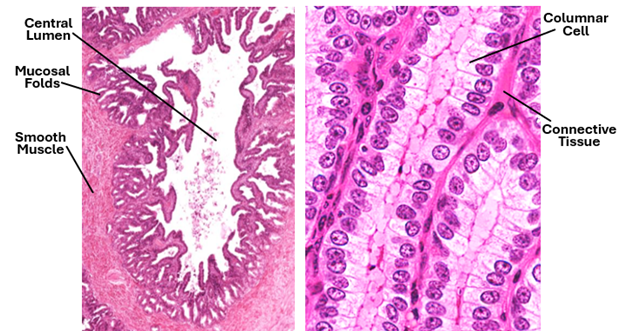 Fig. T13. H&E-stained sections of the seminal vesicle; the low power section (left) shows a central lumen and the numerous mucosal folds continuous with it. The mucosa is surrounded by a smooth muscle layer. The section on the right shows the pale high columnar cells with basal nuclei; it also shows the connective tissue laminae (pink) between the epithelial membranes.