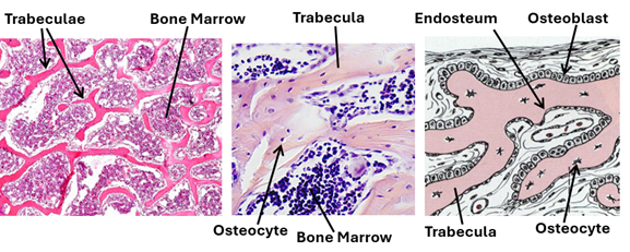 Fig K12. Histological sections and an illustration showing features of spongy bone. Spongy bone is characterized by branching trabeculae and marrow spaces containing bone marrow. The endosteum, osteoblasts and osteocytes are demonstrated in the illustration (left)