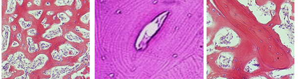 Fig. K8. The histological sections show features of woven bone (left), lamellar compact bone (middle), and lamellar spongy bone (right). Lamellae are seen as feeble lines.