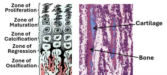 Fig. K16. The illustration (left) shows zones of the epiphyseal plate, whereas the H&E-stained histological section (right) shows the zone calcification containing bone tissue(pink) deposited on cartilage flakes (blue).