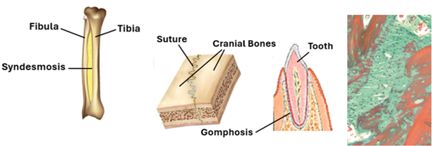 Fig. K19. The three drawings (left and middle two) illustrate the gross appearance of the three different types of fibrous joints, namely: syndesmosis, sutures and gomphosis. The histological section (right) demonstrates the microscopic appearance of fibrous joints. It is a section of one of the cranial sutures stained by Masson’s trichrome stain, where the dense connective tissue stains green and the bone tissue stains red.