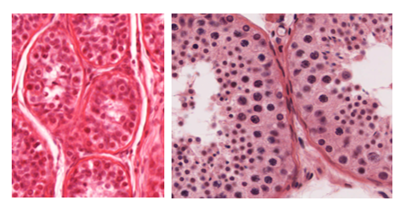 Fig. T4. H&E-stained histological sections of the testis. The one on the left is of a child; it shows low epithelium containing two types of cells. The one on the right is of an adult testis; the epithelium is thick and contains different types of cells arranged in several layers. Spermatogonia are basally located overlying the basement membrane, primary spermatocytes occupy the middle regions of the epithelium and have the largest nuclei, secondary spermatocytes and spermatids occupy the luminal regions and have the smallest nuclei.