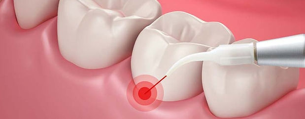 best-gum-treatment-and-surgery-center-in-kuwait.jpg