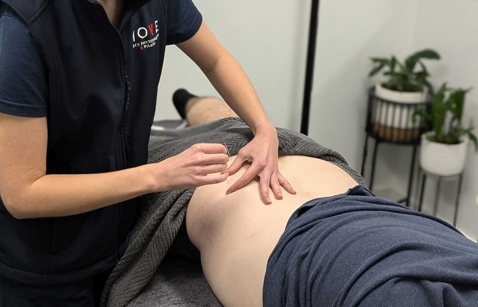 Physiotherapist performing dry needling on client with back pain at Move Sports Physiotherapy in Geelong