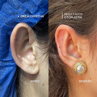 Dr. Otto Gonzalez | Cirujano Plástico Caracas