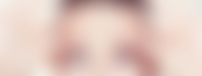 Guía Completa Sobre Arrugas Faciales: ¿Cómo Rejuvenecer Tu Piel Sin Cirugía?