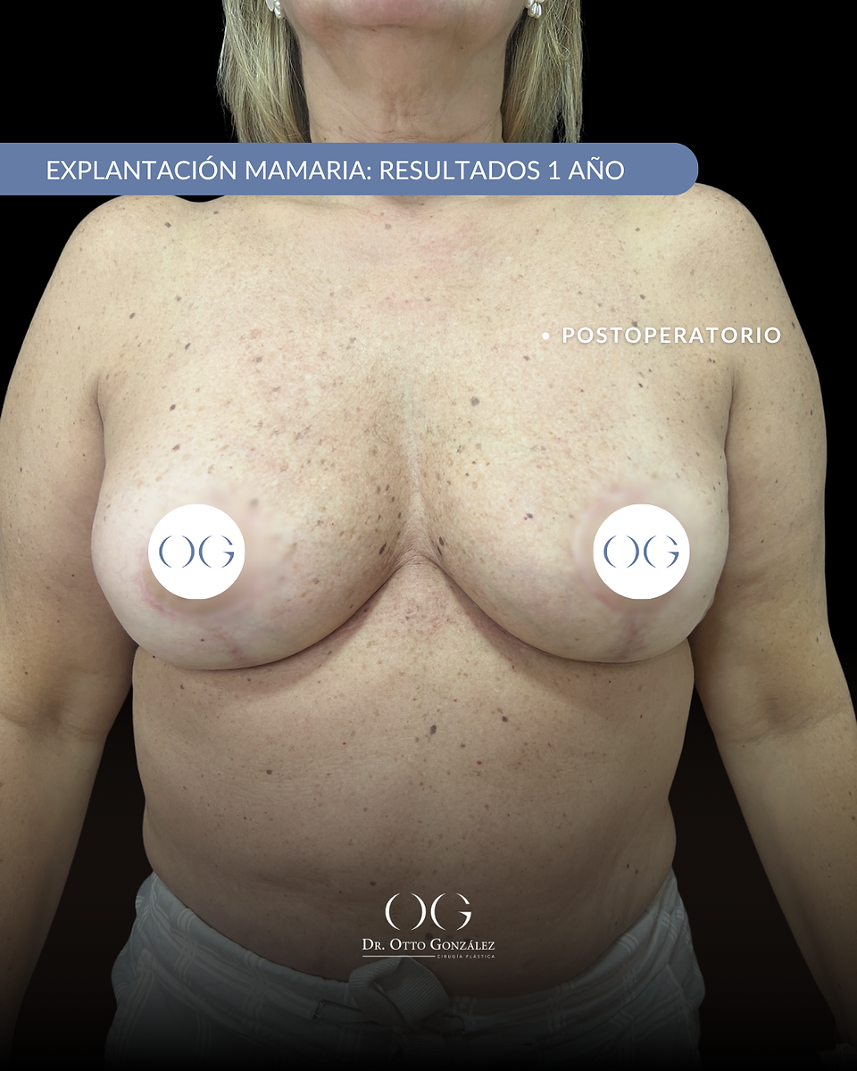 Dr. Otto Gonzalez | Cirujano Plástico Caracas