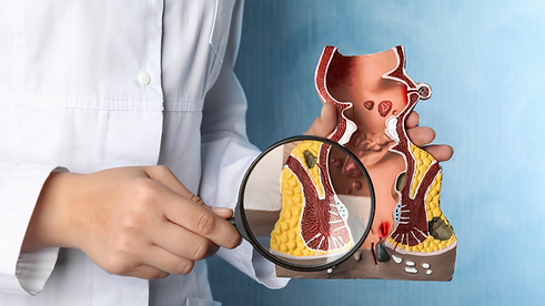 "Médico para hemorroida conversando com paciente sobre sintomas e tratamento."