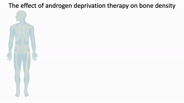 Bone Density Animation for portfolio - compressed.gif