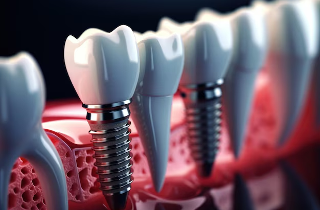 Understanding Your Options: Who Should Choose Dental Implants?