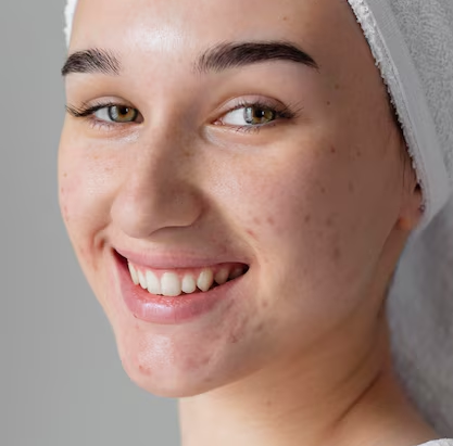 The Financial Landscape of Laser Scar Removal