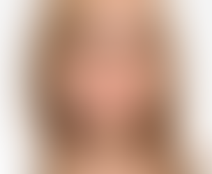 Hair Loss Solutions in Dubai: Wigs for Every Need