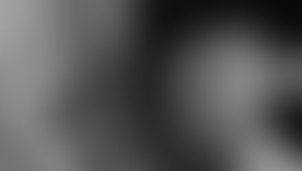 Leg Pain? Understanding Sciatica: What You Need to Know | Physiotherapy