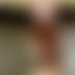 inflammation: the good, the bad, the ugly