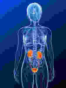 IC is a Bladder Condition