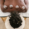 Cupping Therapy_edited.jpg