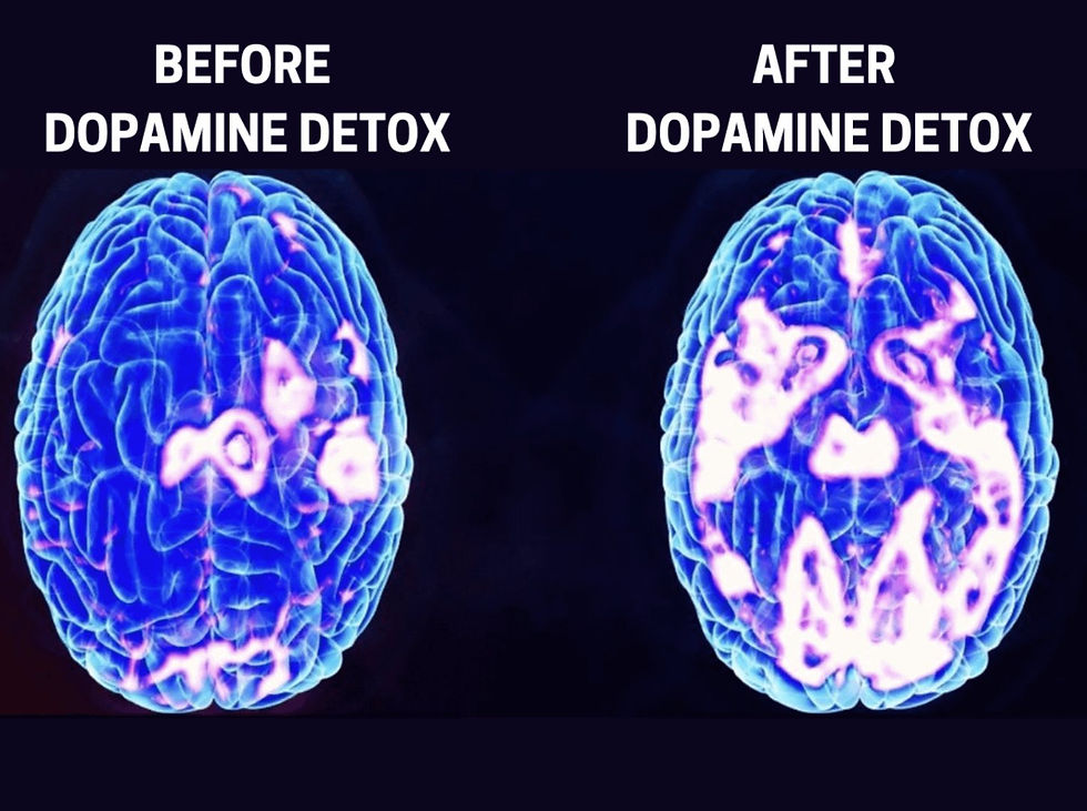 Comparison of brain scans showing the increase in available dopamine receptors post-detox, with the detoxed brain displayed on the right.