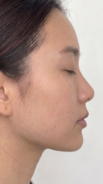 magnific__jaw-line-slightly-define-slightly-abit-__51678.png