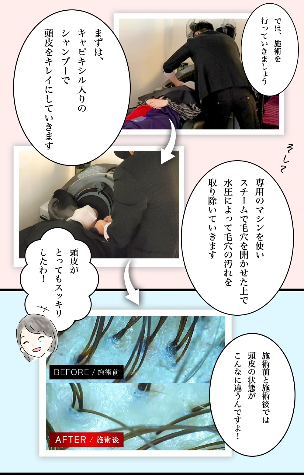 育毛ケア通い放題プラン マンガ説明