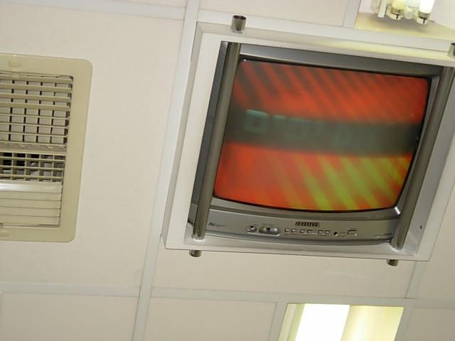מסך הטלווי�זיה בתקרת חדר הטיפול