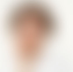 Diş Sıkma Alışkanlığı: Farkında Olmadan Dişlerinize Zarar Veriyor Olabilirsiniz