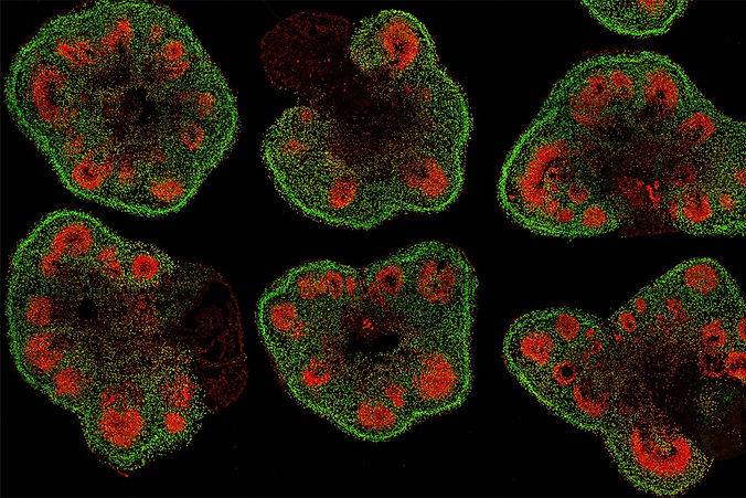 novitch+organoid_2_mid.jpg
