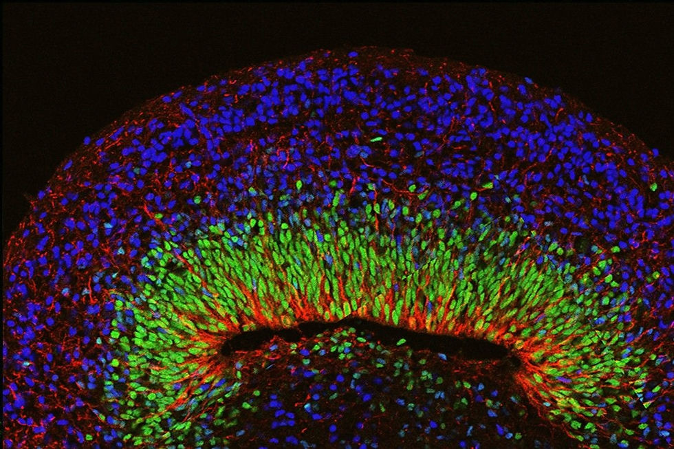 Organoid+image+UCLA_hero_edited.jpg