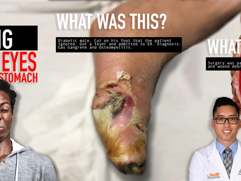 When to See Your Podiatrist About That Wound