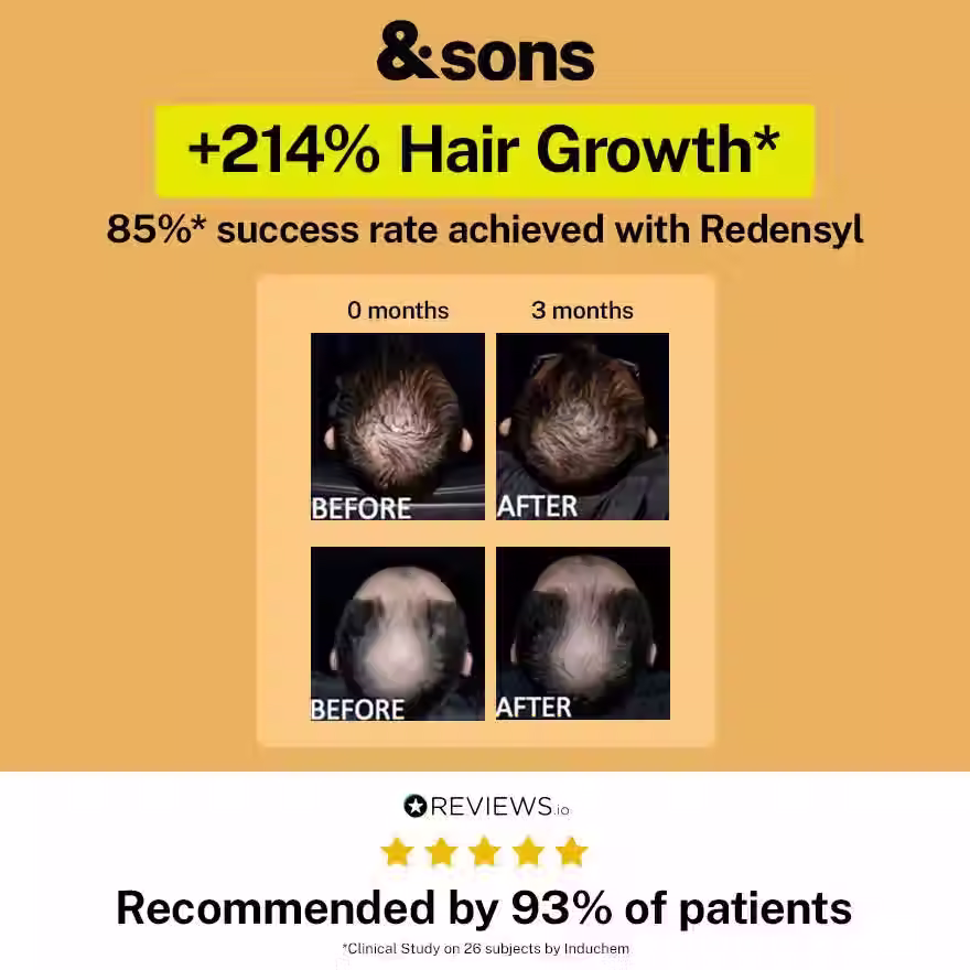 Thumbnail: Intense Hair Growth Kit