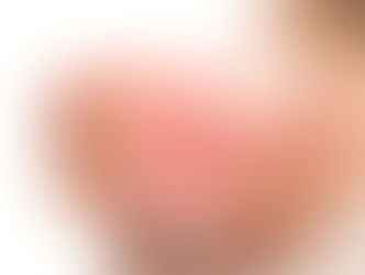 Benefícios da ninfoplastia