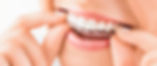 Aligners Near You