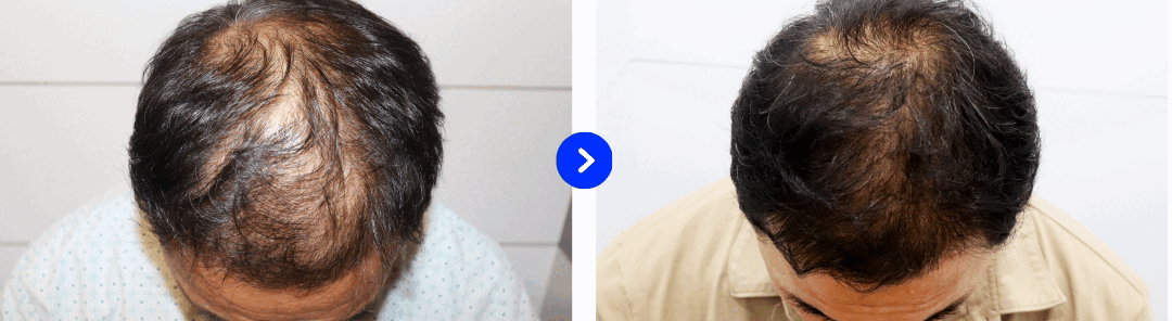 젬마B&A.gif