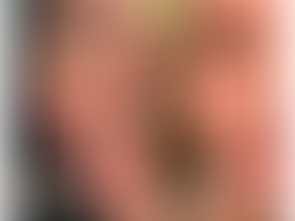 ProFacials Cheltenham chemoical peel results