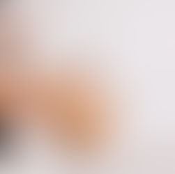 REJUVENATE YOUR SKIN WITH CINCINNATI PLASTIC SURGERY