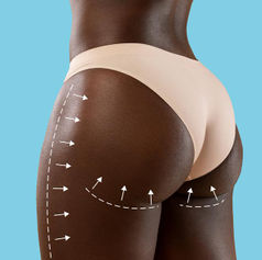 HOW LONG DOES A BBL LAST?